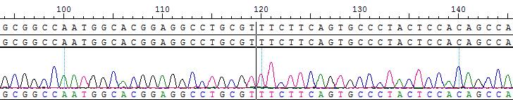 CBP20208R NOTCH1(E2)-NUP214(E25)  KPL4.jpg