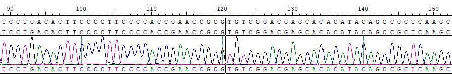 CBP20210R NUP98(E1)-BEAN1(E4)  OVCAR3.png